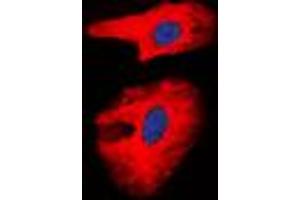 Immunofluorescence (IF) image for anti-Collagen, Type I, alpha 2 (COL1A2) (Center) antibody (ABIN7295318)
