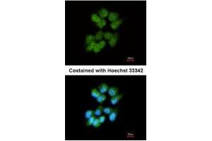 ICC/IF Image Immunofluorescence analysis of methanol-fixed A431, using Slap, antibody at 1:200 dilution. (SLA 抗体)