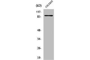 Western Blot analysis of COLO205 cells using Rap1GAP Polyclonal Antibody (RAP1GAP 抗体  (C-Term))