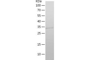 Western Blotting (WB) image for Small Proline-Rich Protein 2F (SPRR2F) (AA 1-72) protein (His-IF2DI Tag) (ABIN7282583) (SPRR2F Protein (AA 1-72) (His-IF2DI Tag))