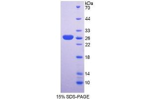 SDS-PAGE analysis of Mouse SNAG1 Protein. (SNX18 蛋白)