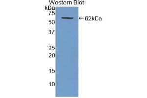 Western Blotting (WB) image for anti-Wingless-Type MMTV Integration Site Family, Member 5A (WNT5A) (AA 62-380) antibody (ABIN3210025) (WNT5A 抗体  (AA 62-380))