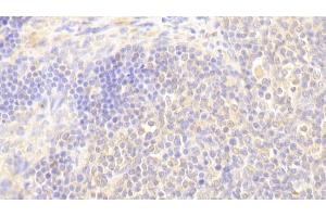 Detection of BLK in Human Lymph node Tissue using Polyclonal Antibody to B-Lymphoid Tyrosine Kinase (BLK) (BLK 抗体  (AA 241-494))