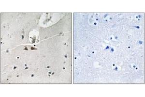 Immunohistochemistry analysis of paraffin-embedded human brain, using Ephrin B1/B2/B3 (Phospho-Tyr324) Antibody. (Ephrin B1/B2/B3 (AA 290-339), (pTyr324) 抗体)