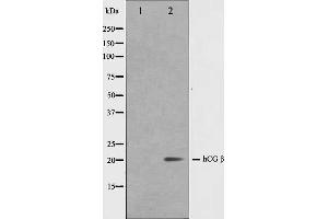Western blot analysis on NIH-3T3 cell lysate using hCG beta Antibody,The lane on the left is treated with the antigen-specific peptide. (HCG beta 抗体)