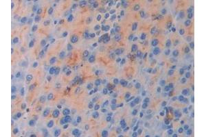 IHC-P analysis of Mouse Pancreas Tissue, with DAB staining. (IL18R1 抗体  (AA 182-336))