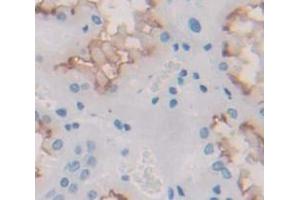 IHC-P analysis of Human Tissue, with DAB staining. (IL12RB1 抗体  (AA 429-603))