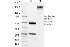 SDS-PAGE Analysis Purified CD20 Mouse Monoclonal Antibody (L26).