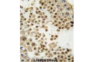 Immunohistochemistry (IHC) image for anti-Parkinson Protein 2, E3 Ubiquitin Protein Ligase (Parkin) (PARK2) antibody (ABIN3002636) (Parkin 抗体)