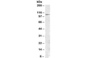 Western blot testing of human substantia nigra lysate with MTHFD1 antibody at 1ug/ml. (MTHFD1 抗体)
