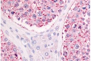 Human Testis (formalin-fixed, paraffin-embedded) stained with GPR68 antibody ABIN213456 at 10-20 ug/ml followed by biotinylated goat anti-rabbit IgG secondary antibody ABIN481713, alkaline phosphatase-streptavidin and chromogen. (GPR68 抗体  (Extracellular Domain))