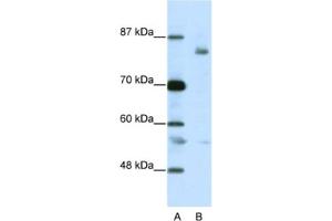 Western Blotting (WB) image for anti-Leucine-Zipper-Like Transcription Regulator 1 (LZTR1) antibody (ABIN2461800) (LZTR1 抗体)