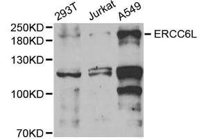 Western Blotting (WB) image for anti-Excision Repair Cross-Complementing Rodent Repair Deficiency, Complementation Group 6-Like (ERCC6L) (AA 300-400) antibody (ABIN6140273)