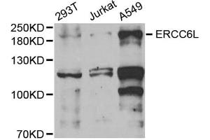 Western blot analysis of extracts of various cell lines, using ERCC6L antibody (ABIN6134675, ABIN6140273, ABIN6140275 and ABIN6221741) at 1:1000 dilution. (ERCC6L 抗体  (AA 300-400))