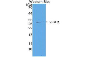 Western Blotting (WB) image for anti-Matrix Metallopeptidase 14 (Membrane-inserted) (MMP14) (AA 322-541) antibody (ABIN1980455) (MMP14 抗体  (AA 322-541))