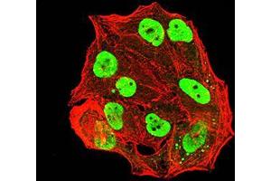 Immunofluorescence analysis of Hela cells using ESR1 mouse mAb (green). (Estrogen Receptor alpha 抗体  (AA 2-185))