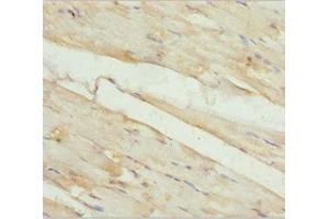 Immunohistochemistry of paraffin-embedded human skeletal muscle tissue using ABIN7157248 at dilution of 1:100 (KBTBD3 抗体  (AA 1-350))