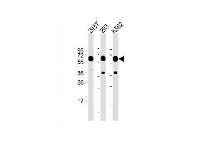 All lanes :SET07 Antibody at 1:2000 dilution Lane 1: 293T whole cell lysate Lane 2: 293 whole cell lysate Lane 3: K562 whole cell lysate Lysates/proteins at 20 μg per lane. (SETD8 抗体  (N-Term))