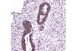 IHC analysis of Caspase 4 using anti-Caspase 4 antibody . (Caspase 4 抗体  (AA 111-194))