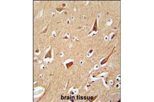 Immunohistochemistry (IHC) image for anti-Zinc Finger, FYVE Domain Containing 28 (ZFYVE28) (AA 604-633), (C-Term) antibody (ABIN5538179)
