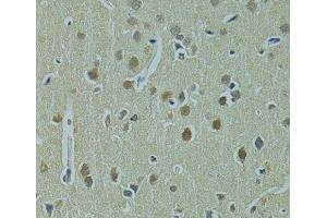 Immunohistochemistry of paraffin-embedded Rat brain using UBE2I Polyclonal Antibody at dilution of 1:100 (40x lens). (UBE2I 抗体)