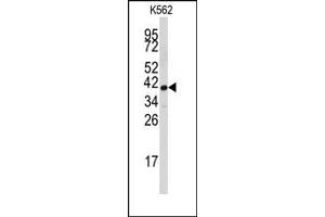 Image no. 1 for anti-Fibrillarin (FBL) (Middle Region) antibody (ABIN357938) (Fibrillarin 抗体  (Middle Region))
