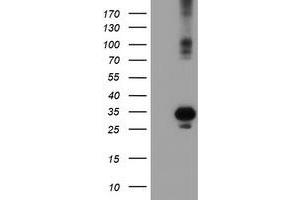 Western Blotting (WB) image for anti-Suppressor of Cytokine Signaling 3 (SOCS3) antibody (ABIN1501063) (SOCS3 抗体)