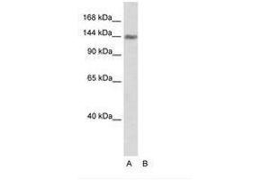 Image no. 1 for anti-Timeless Homolog (TIMELESS) (C-Term) antibody (ABIN202978) (TIMELESS 抗体  (C-Term))