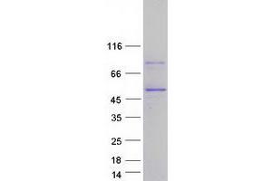 Western Blotting (WB) image for Poly(rC) Binding Protein 4 (PCBP4) (Transcript Variant 4) protein (Myc-DYKDDDDK Tag) (ABIN2728359)