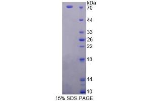 Image no. 1 for Protoporphyrinogen Oxidase (PPOX) (AA 12-471) protein (His tag,GST tag) (ABIN6237139)