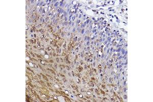Immunohistochemistry of paraffin-embedded human cervical using SSC/SerpinB3 Rabbit mAb (ABIN7270242) at dilution of 1:100 (40x lens). (SERPINB3 抗体)