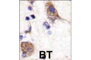Formalin-fixed and paraffin-embedded human brain tissue reacted with SCYL2 , which was peroxidase-conjugated to the secondary antibody, followed by DAB staining. (SCYL2 抗体  (C-Term))