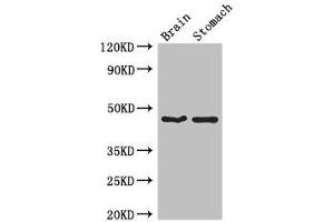 Western Blot Positive WB detected in: Mouse brain tissue, Mouse stomach tissue All lanes: TBC1D20 antibody at 4 μg/mL Secondary Goat polyclonal to rabbit IgG at 1/50000 dilution Predicted band size: 46, 20, 49 kDa Observed band size: 46 kDa