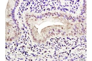 Paraformaldehyde-fixed, paraffin embedded rat uterus tissue, Antigen retrieval by boiling in sodium citrate buffer(pH6) for 15min, Block endogenous peroxidase by 3% hydrogen peroxide for 30 minutes, Blocking buffer (normal goat serum) at 37°C for 20min, Antibody incubation with Rabbit Anti-Estrogen receptor alpha (Ser118) Polyclonal Antibody, Unconjugated  at 1:400 overnight at 4°C, followed by a conjugated secondary and DAB staining (Estrogen Receptor alpha 抗体  (pSer118))