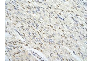 Rabbit Anti-FOXJ3 antibody        Paraffin Embedded Tissue:  Human Heart cell   Cellular Data:  Epithelial cells of renal tubule  Antibody Concentration:   4. (FOXJ3 抗体  (Middle Region))