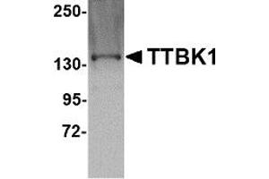 Western Blotting (WB) image for anti-tau Tubulin Kinase 1 (Ttbk1) (C-Term) antibody (ABIN1030783) (TTBK1 抗体  (C-Term))