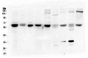 Western blot analysis of ARSA using anti-ARSA antibody (ABIN5692787).