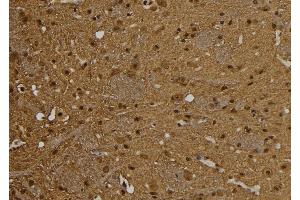 Immunohistochemistry (IHC) image for anti-Proteasome (Prosome, Macropain) Activator Subunit 1 (PA28 Alpha) (PSME1) (C-Term) antibody (ABIN6264493)