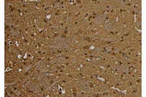 ABIN6277542 at 1/100 staining Rat brain tissue by IHC-P. (PSME1 抗体  (C-Term))