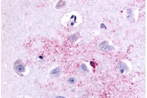 Anti-PAK6 antibody  ABIN1049228 IHC staining of human brain, neurons and glia. (PAK6 抗体  (Linker Domain))