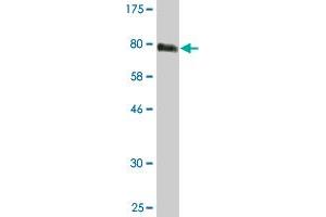 Western Blot detection against Immunogen (76. (STK38 抗体  (AA 1-465))