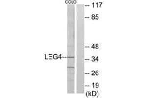 Western blot analysis of extracts from COLO cells, using LEG4 Antibody. (GAL4 抗体  (AA 61-110))