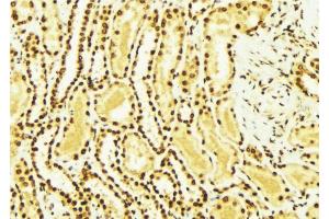 ABIN6269364 at 1/100 staining Mouse kidney tissue by IHC-P. (ERBB4 抗体  (C-Term))