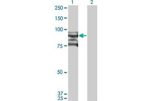Western Blot analysis of TOP3B expression in transfected 293T cell line by TOP3B monoclonal antibody (M03), clone 1H8. (TOP3B 抗体  (AA 1-862))