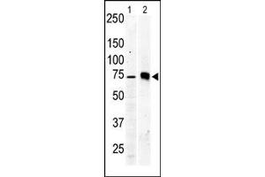 The anti-PKC beta2 Pab is used in Western blot to detect PKC beta2 in Jurkat cell lysate (lane 1) and mouse brain tissue lysate (lane 2). (PKC beta 抗体  (C-Term))