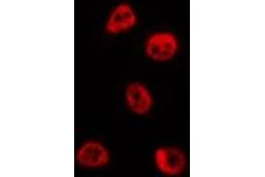 ABIN6273993 staining HepG2 by IF/ICC. (BCL6 抗体  (Internal Region))