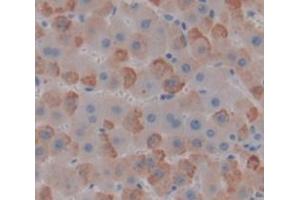 Used in DAB staining on fromalin fixed paraffin- embedded liver tissue (GUCY1B3 抗体  (AA 408-619))
