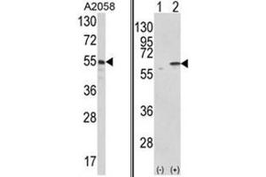 (LEFT) Western blot analysis of PDIA3 Antibody (C-term) in A2058 cell line lysates (35ug/lane). (PDIA3 抗体  (C-Term))