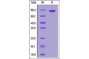 Human PTK7, His Tag on  under reducing (R) condition. (PTK7 Protein (AA 31-704) (His tag))