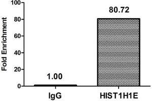 Chromatin Immunoprecipitation Hela (4*10 6 , treated with 30 mM sodium butyrate for 4h) were treated with Micrococcal Nuclease, sonicated, and immunoprecipitated with 8 μg anti-HIST1H1E (ABIN7139163) or a control normal rabbit IgG. (HIST1H1E 抗体  (acLys16))